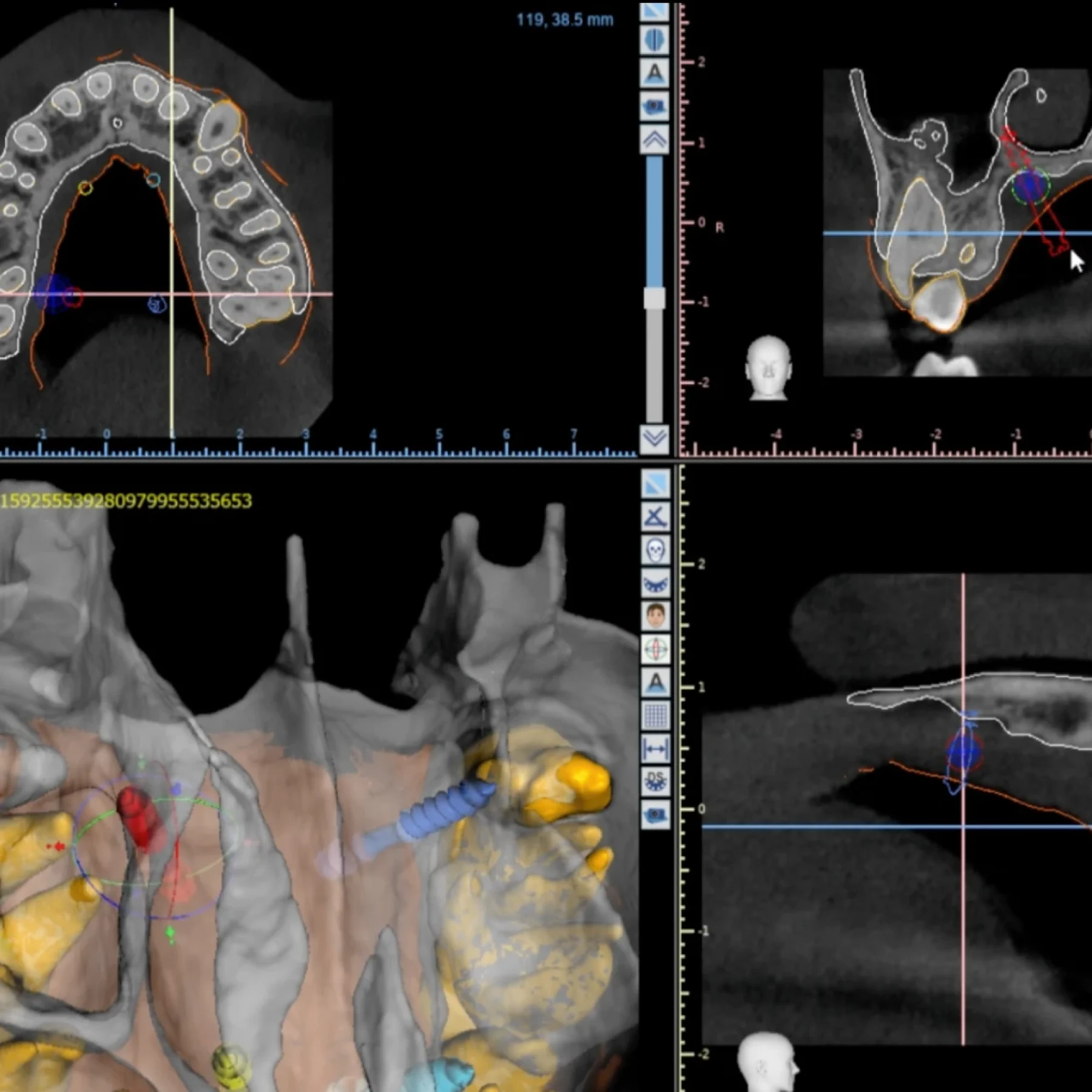 Radiografías de dientes y dentaduras